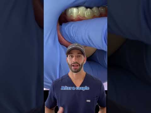 Invisalign Pain: Will it hurt, and is it better or worse than braces?
