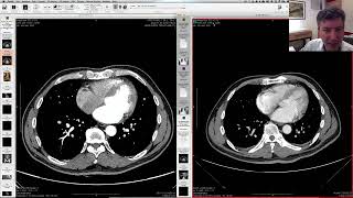 Sincronizando Exames