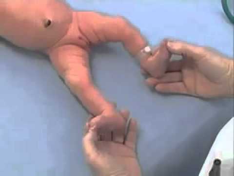 Newborn Examination of the back and feet