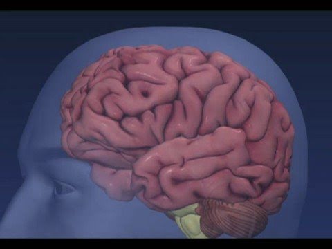 Frontotemporal Dementia