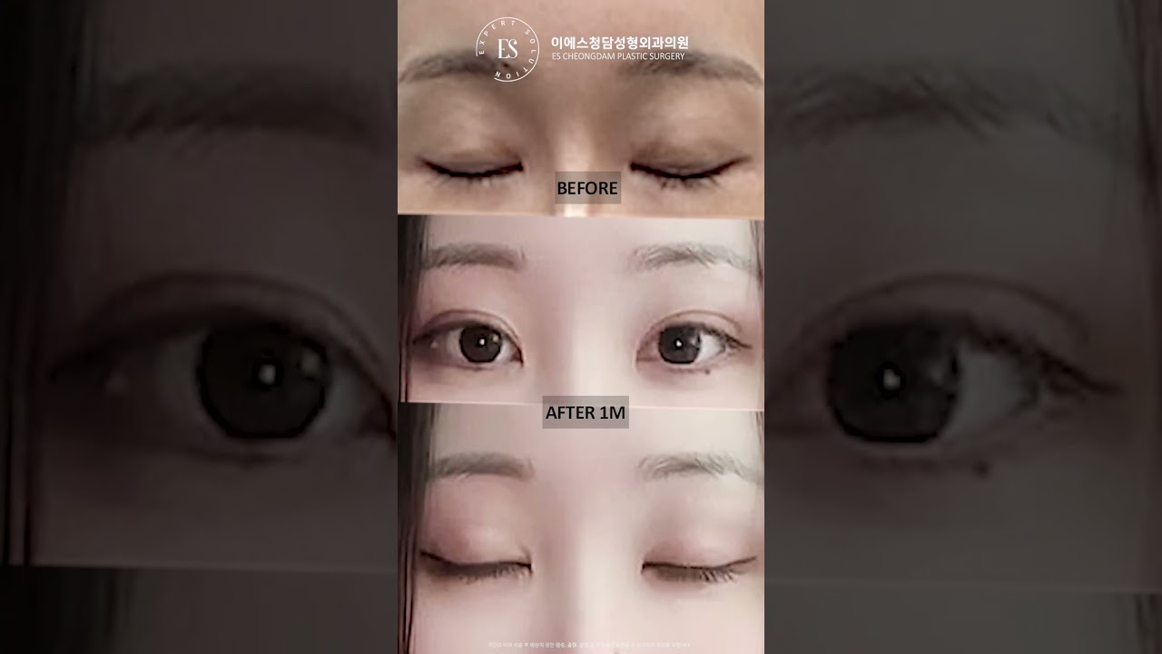 이에스 유튜브