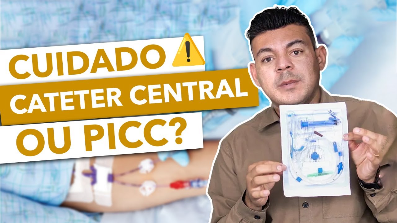 Cateter Venoso Central: o que você PRECISA entender AGORA!