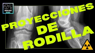 ✅PROYECCIONES DE RODILLA, ROTULA Y FEMUR