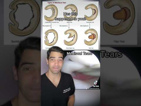 Orthopedic surgeon talks about different types of meniscus tears and how to fix and treat them