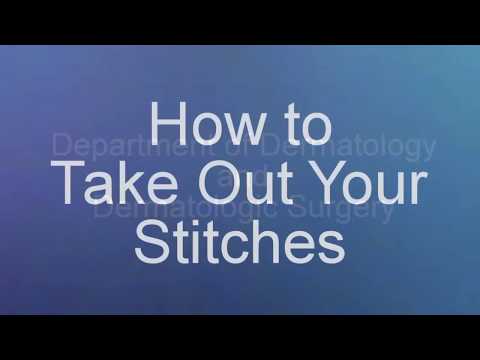 How to Take Out Your Stitches after Skin Procedures