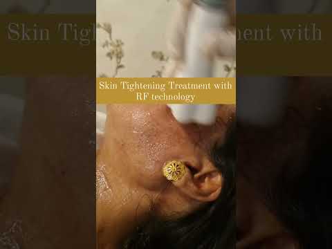 Venus Freeze treatment for Skin Tightening | Beyond Aesthetics by NS3