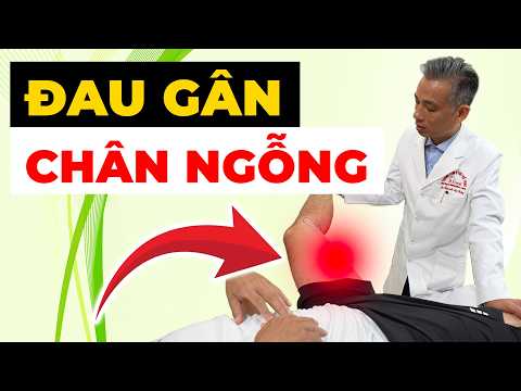 Đau Gân Chân Ngỗng: Tại Sao Càng Đi Lại Càng Đau Và Dễ Bỏ Sót?