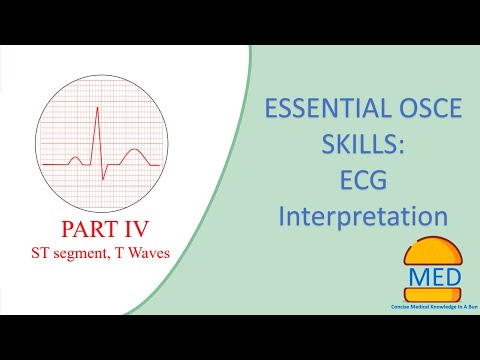 OSCE ESSENTIALS - ECG INTERPRETATION PART 4 - ST segment and T waves