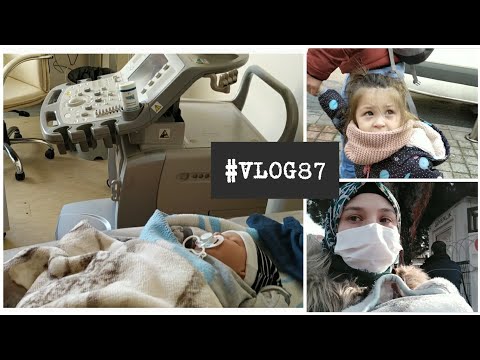 3 YAŞ ÇOCUK BOY VE KİLO GELİŞİMİ⁉️BEBEK KALÇA ULTRASONU👶KONUŞAMAYAN ÇOCUĞA DİL EĞİTİMİ☑️# VLOG87