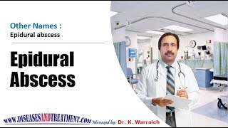 Download Lagu Epidural abscess : Causes, Diagnosis, Symptoms, Treatment, Prognosis Thumbnail