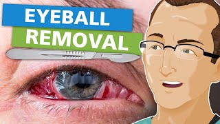 Eyeball Removal