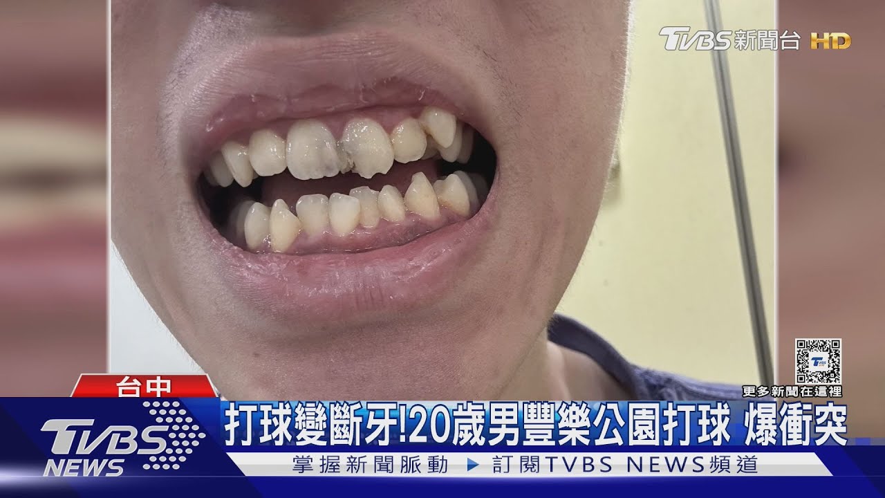 打球變斷牙!20歲男豐樂公園打球爆衝突