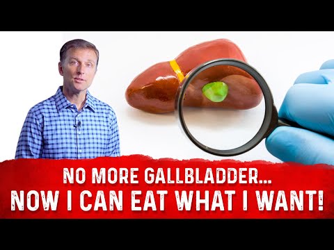 Gallbladder Removed: Can I Eat What I Want? – Dr. Berg