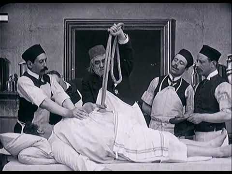 Opération chirurgicale (1905) Surgical Operation (Pathé)