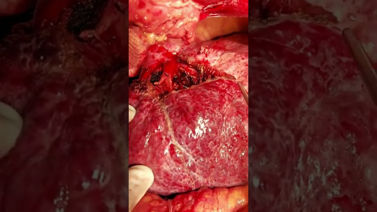 Pablo Duarte Rodrigues-20