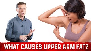What Causes Upper Arm Fat? Losing Fat From Arms Dr.Berg