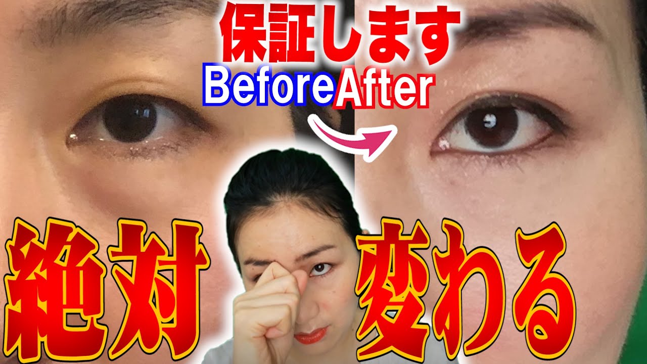 Download 瞼の脂肪を落とす1週間で絶対パッチ Download 瞼の脂肪を落とす1週間で絶対パッチ