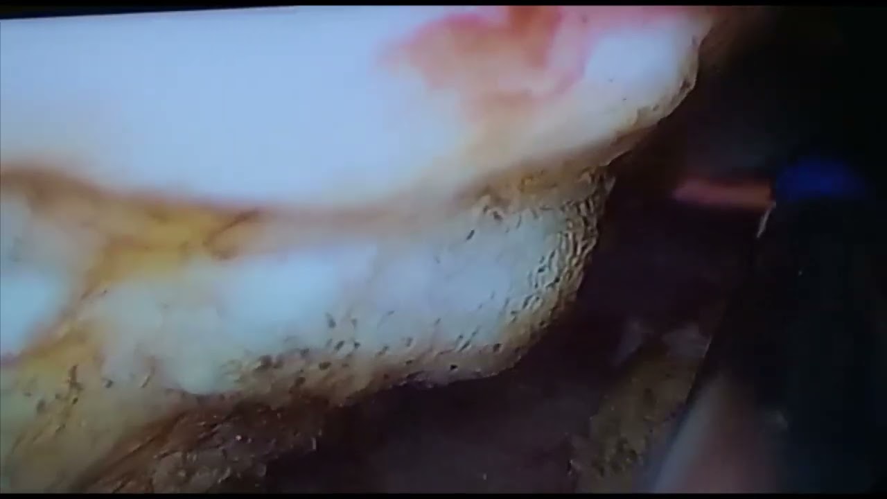 Juventino Lopez Lopez-10