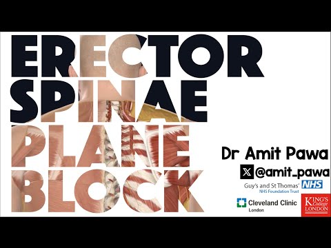 Erector Spinae Plane Block - RA-UK Webinar version