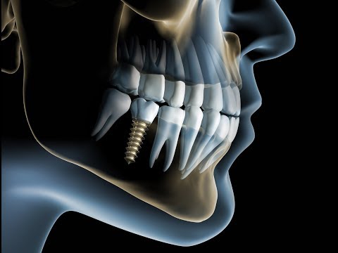 Kissen orthopädische Osteochondrose Kiefergelenk Klicks