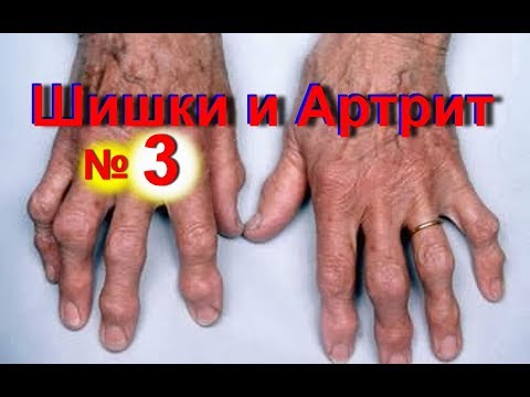 Где сделать замену коленного сустава Рентгенограмма шейного отдела позвоночника как делают