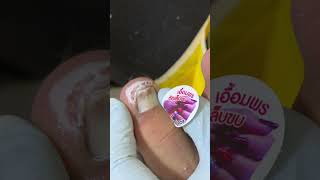 Ep_8172 Foot nails skin removal 👣 ชอบตัดเล็บเล่นครับ 😄 (clip from Thailand)