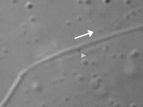 17 5 Organelle Movement on Microtubules