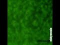 Ekhymosis-SANGRE DE RATA-Juanes-(josemar ...