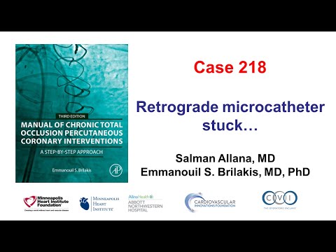 Case 218: Manual of CTO PCI - Retrograde microcatheter entrapment