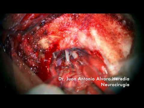 Juan Antonio Alvaro Heredia-10