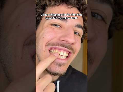 Crest whitening strips available @tdawi.egypt 🎉#Crest #WhiteningStrips #BrighterSmile #ConfidentYou