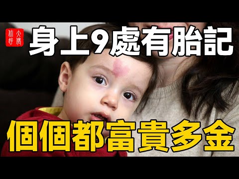 腿上有胎記