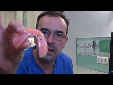 Successful and simple mini implants for the edentulous lower jaw - safe, fast and affordable