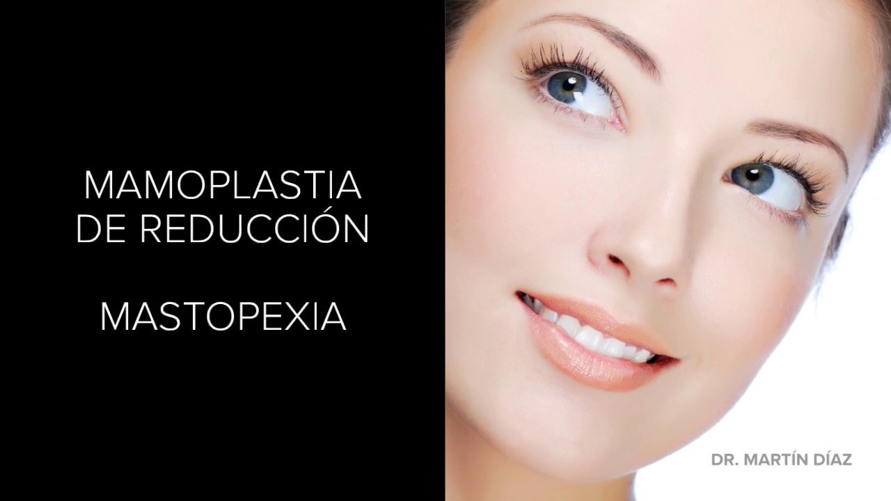 Marcos Martín Díaz-9