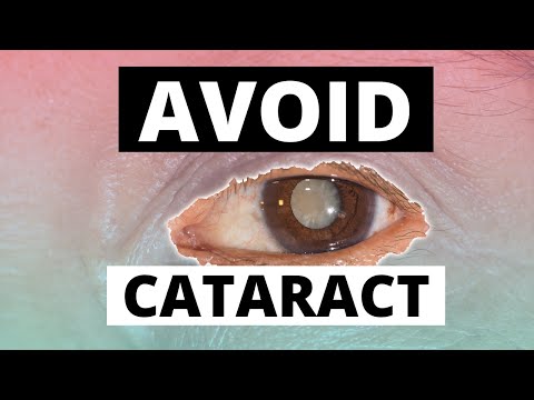 6 Key causes of cataracts and how to prevent it