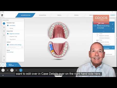 Dica do Dia: Conectores da Ponte Posterior