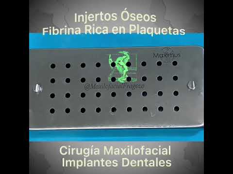 Injertos óseos para cirugía maxilofacial e implantes dentales - Maxilofacial Fragozo Barranquilla