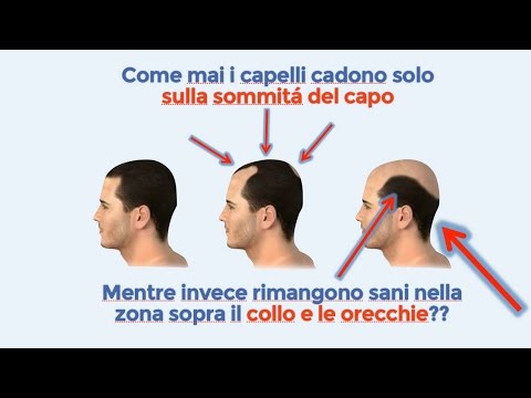 Testa molto dolorante da dietro al collo Ricette di stili di vita sani per le articolazioni