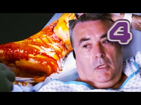 download lagu mp3 mp4 Foot Accident, download lagu Foot Accident gratis, unduh video klip Foot Accident