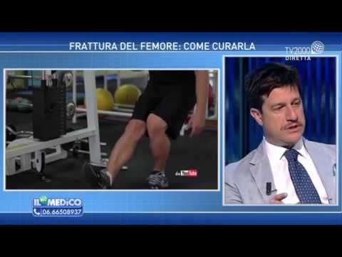 A ciò che il medico per affrontare al ginocchio infiammazione delle articolazioni Curare per giunti Honda Prezzo