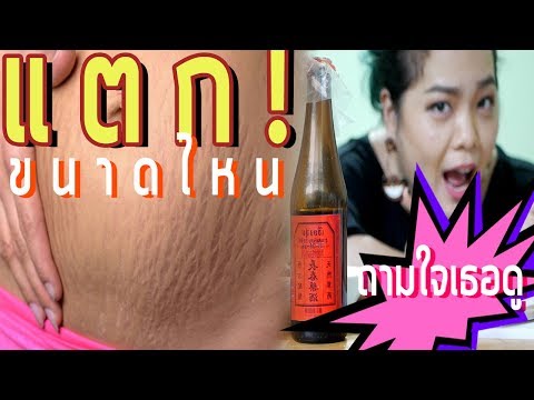 ถ้าหน้าอกขนาดเล็กจากที่ที่มันขึ้นอยู่กับ โรส Syabitova เพิ่มขึ้นเต้านม