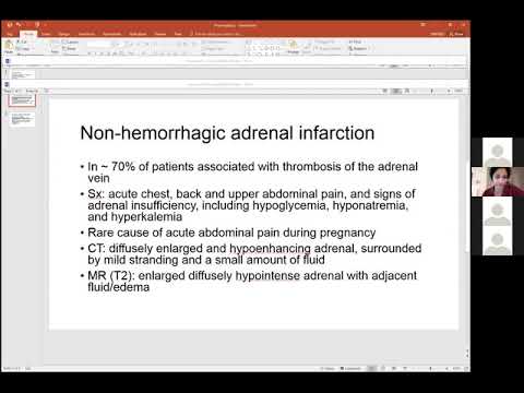 Unusual gallbladder mass - Dr. Victoria Chernyak