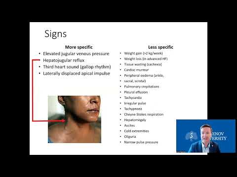 Heart failure (english) A. Rodionov