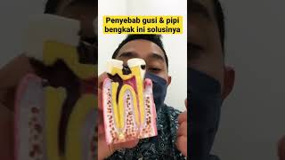 Download lagu SOLUTION TO THE CAUSE OF SWELLING GUMS & CHEEKS #solutiontoswollengums #solutiontoswollencheeks #... mp3