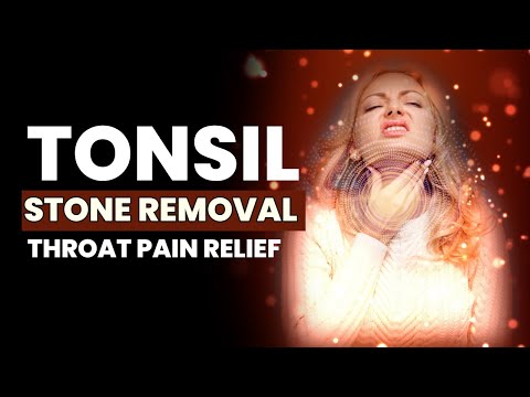 Tonsil Stone Removal | Throat Pain Relief | Heal Your Tonsils | All Throat Problems Healing | 741Hz