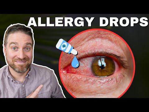 Best Allergy Eye Drops For Red Itchy Eyes! (2025)