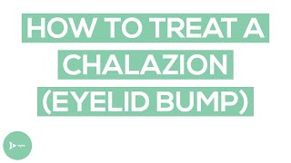 Chalazion (Eyelid Bump) Treatment | Exactly How To Treat a Chalazion