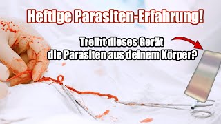 Heftige Parasitenkur-Erfahrung | Massive Parasiten-Ausleitung in kurzer Zeit | Vitori Kristallmatte