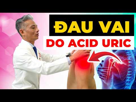 TẠI SAO ACID URIC CAO LẠI GÂY ĐAU VAI? 90% NGƯỜI VIỆT ĐANG HIỂU SAI