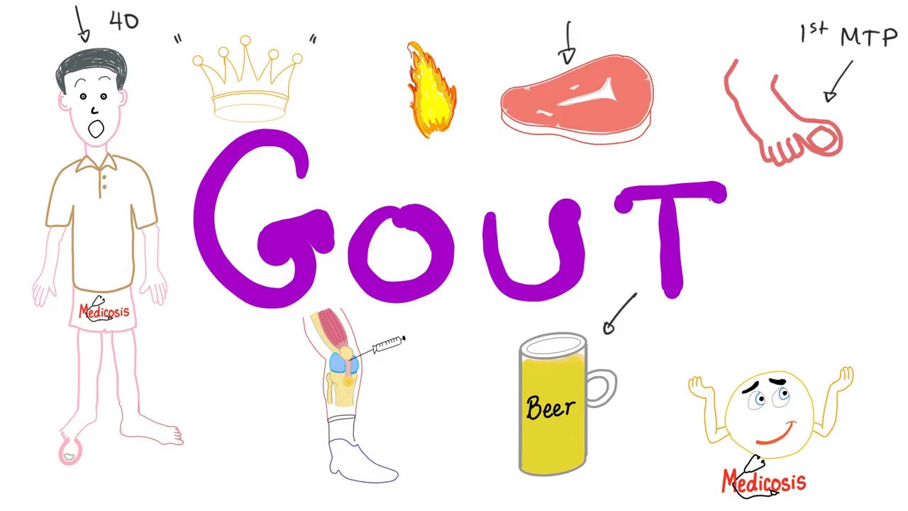 Gout
